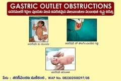 Gastric Outlet Obstruction