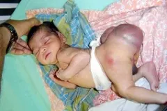 Jayamma