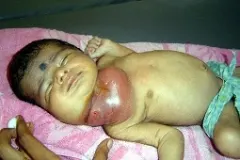 Swapna
