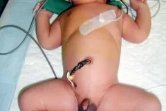 Veerendra